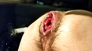 Simply fisting my cast off crevice with the addition of prolapse:)