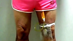 Catheter apropos collecting sac apart from pinky 396